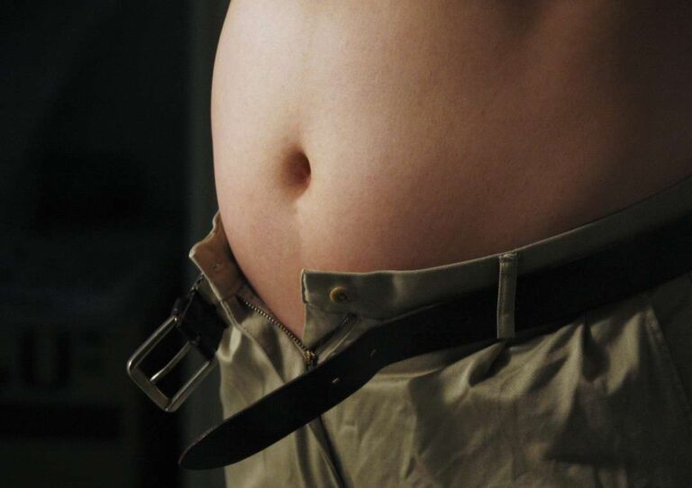 شیوع بالای چاقی