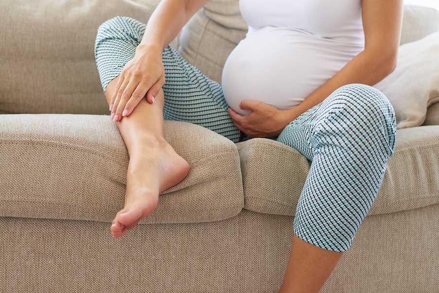 درمان واریس در بارداری